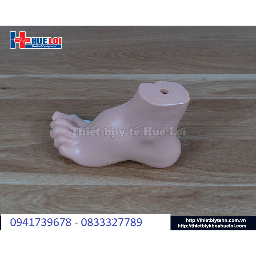 Mô hình bàn chân bệnh lý