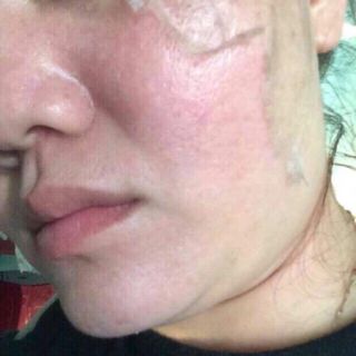 Serum Tái Tạo Trắng Da