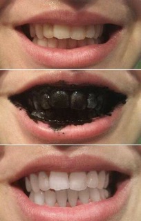 Bột Than Tre Hoạt Tính Trắng Răng