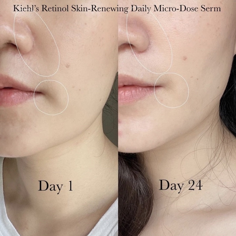 30ml / 50ml - Tinh chất Retinol Kiehls / Kiehl’s Retinol Micro Dose