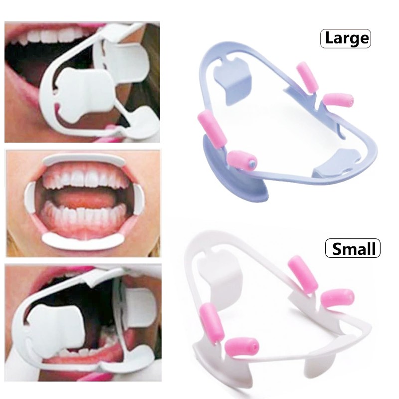 Dụng Cụ Mở Miệng Bằng Nhựa 3D Chuyên Dụng Cho Nha Khoa