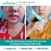 [BỘ BA] Dung Dịch Dizigone 500ml &amp; Xịt Dizigone Spray &amp; Kem Bôi Dizigone Nano Bạc - Kháng Khuẩn, Tái Tạo Da, Ngừa Sẹo