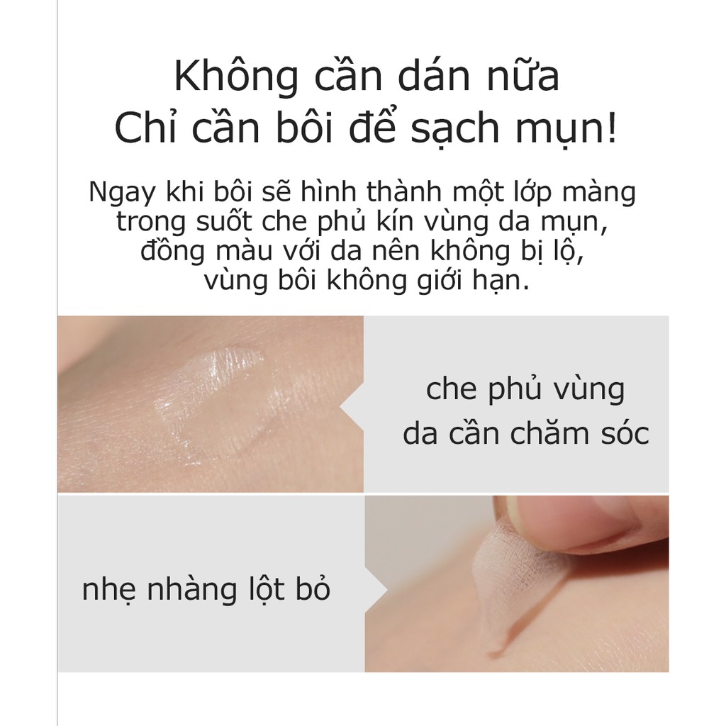 Gel Bôi Mụn Acsys Spot Gel Patch