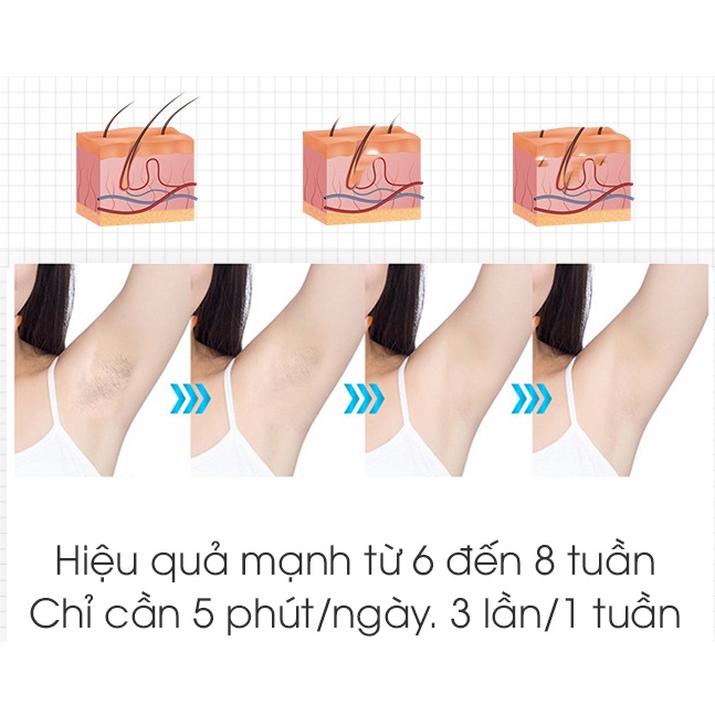 Máy Triệt Lông Laser Toàn Thân B500 Thế Hệ Mới,Triệt Lông Vĩnh Viễn Đơn Giản Tại Nhà - Bh 12 Tháng