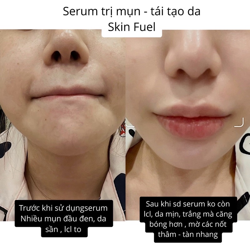 Serum tái tạo làn da Skin Fuel | BigBuy360 - bigbuy360.vn