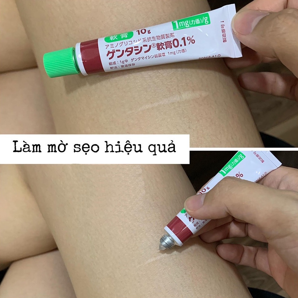 Kem mờ sẹo Gentacin Nhật Bản tuýp 10g