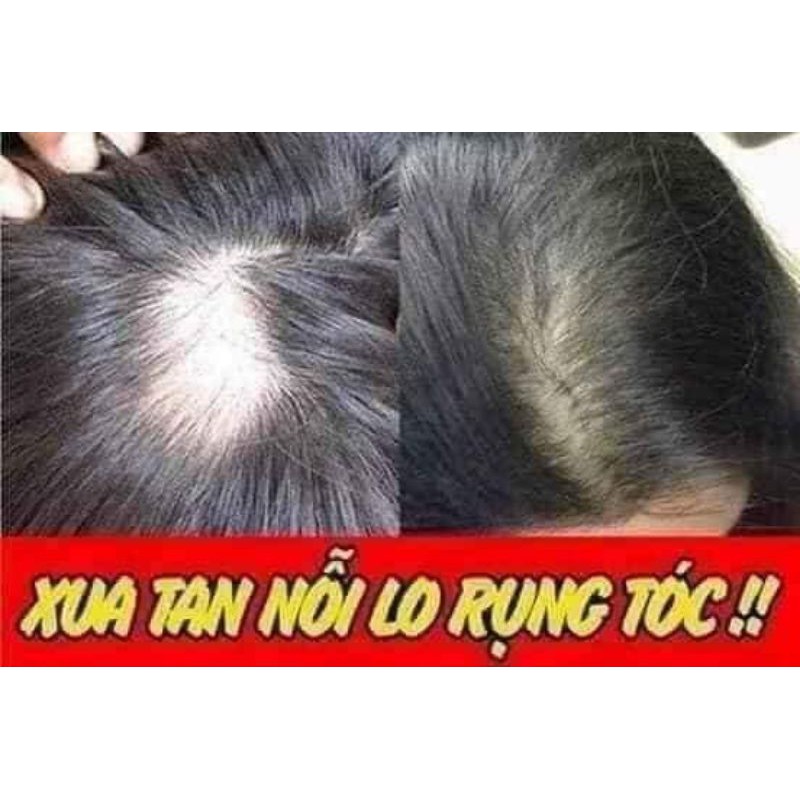 Dầu gội ngăn rụng tóc Ngân bÌnh