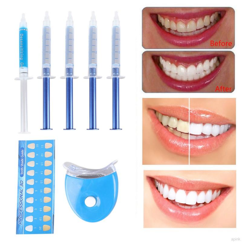 [Hàng mới về] Bộ sản phẩm hỗ trợ làm trắng răng chất lượng cao