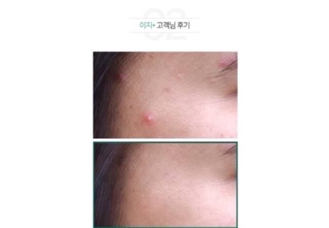 Tinh Chất Giảm Mụn Some By Mi AHA-BHA-PHA 30 Days Miracle Serum