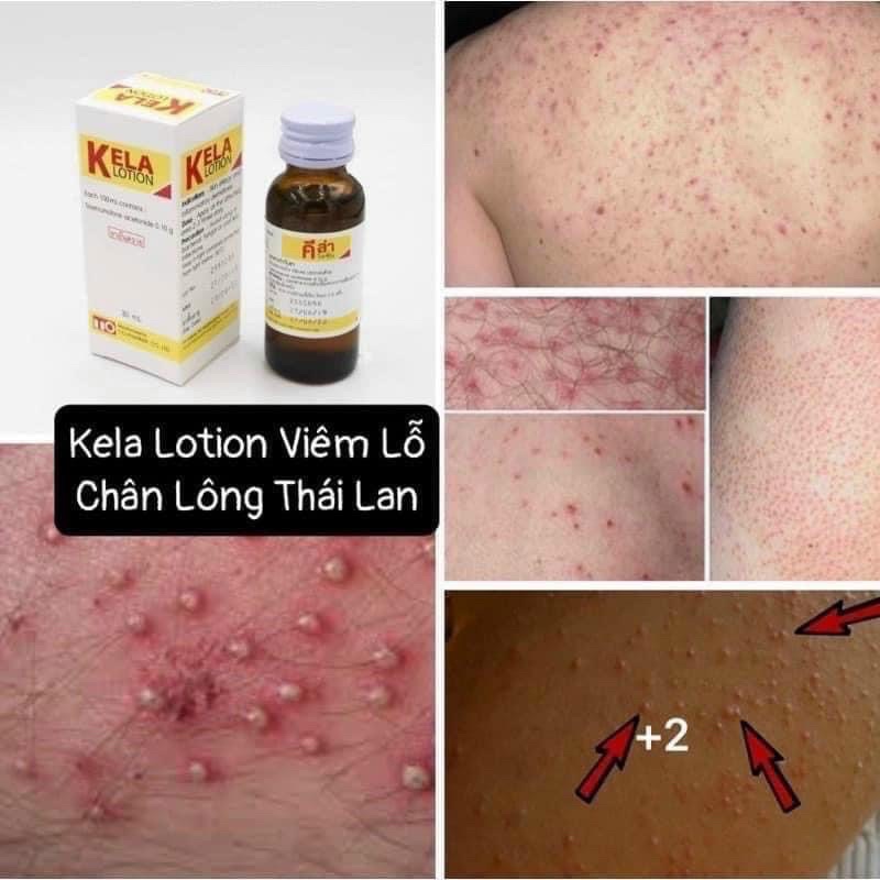 KELA LOTION vıe. m LỖ châŋ LÔNG THÁI LAN 60M
