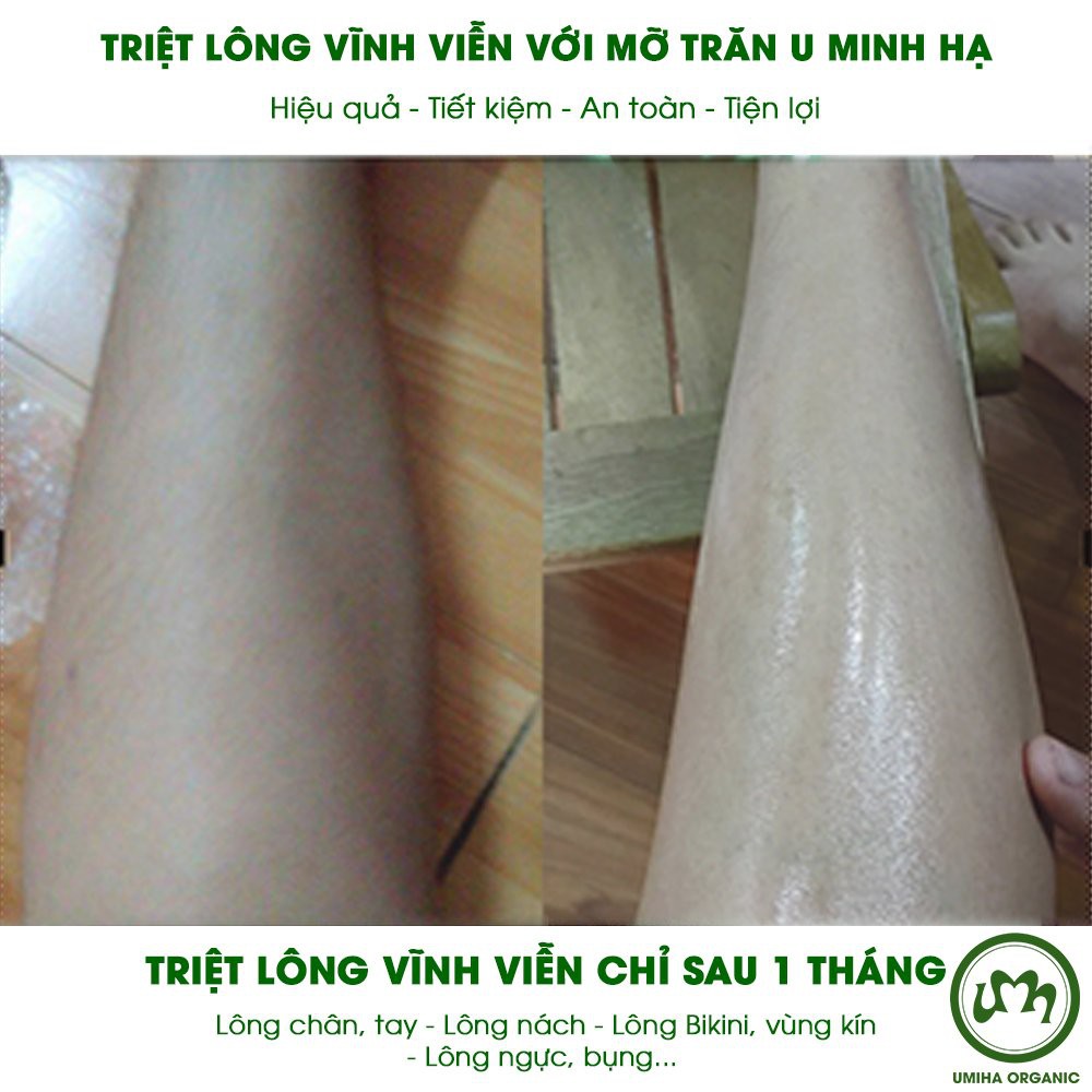 Triệt lông Bikini Vùng Kín vĩnh viễn tại nhà bằng Combo Mỡ Trăn triệt lông U Minh Hạ 10ml và Kem tẩy lông Umi 4C 100ml