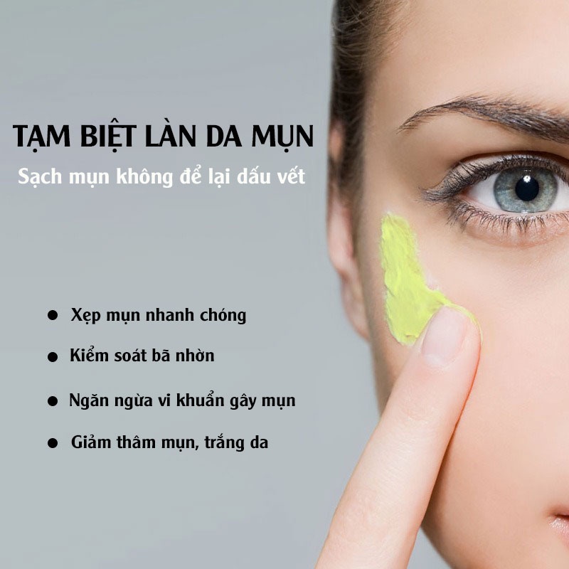 Kem ngừa mụn - Trắng da - Ngừa vết thâm MyLove chính hãng Long Phụng Khang