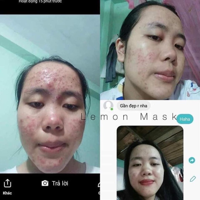 [MUA 1 TẶNG 4] - LEMON MASK KHỔ QUA RỪNG | BigBuy360 - bigbuy360.vn