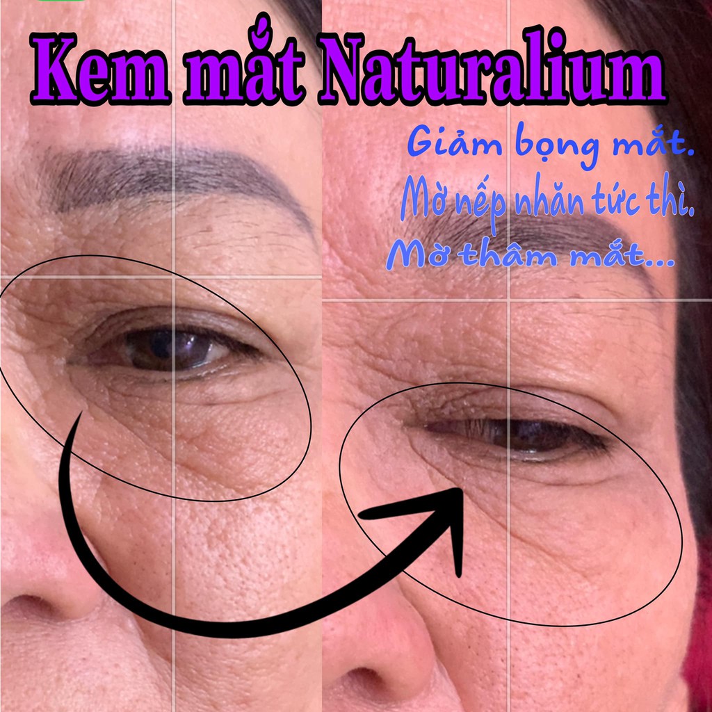 KEM MẮT NATURALIUM - NÂNG CƠ, GIẢM BỌNG MẮT, QUẦNG THÂM, NẾP NHĂN