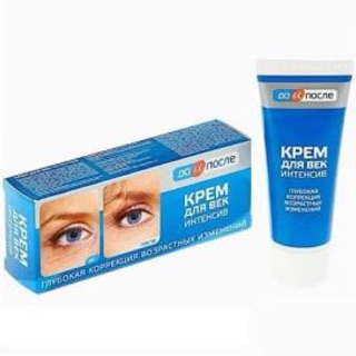 Kem xóa nếp nhăn vùng mắt Kpem