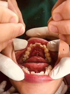 GƯƠNG CHỈNH NHA