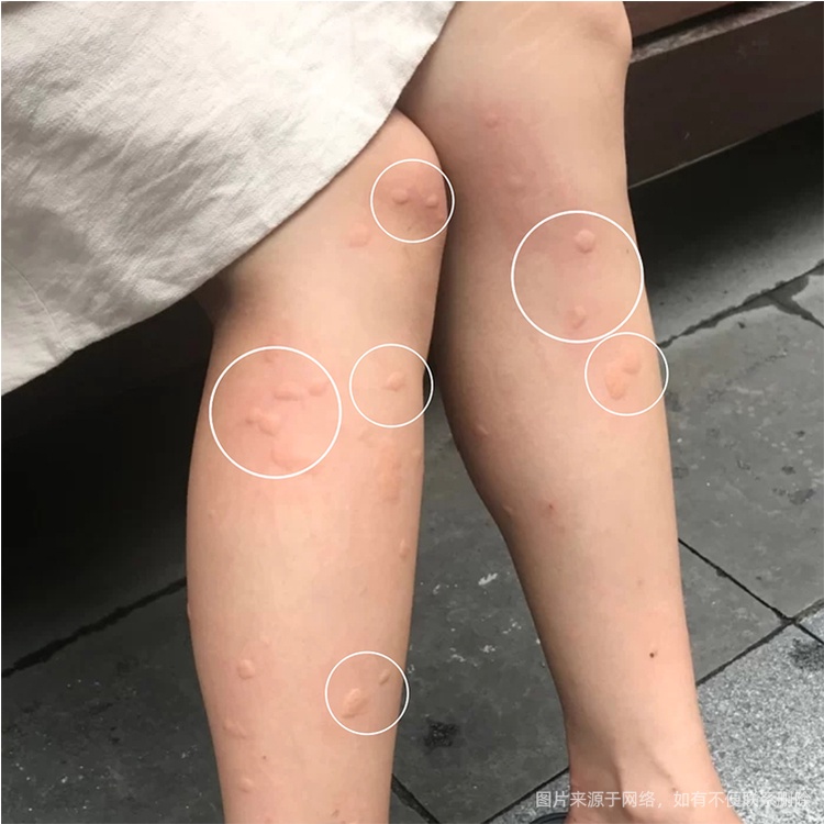 Kem Chống Muỗi Hengai 6.5g Nhỏ Gọn Tiện Dụng