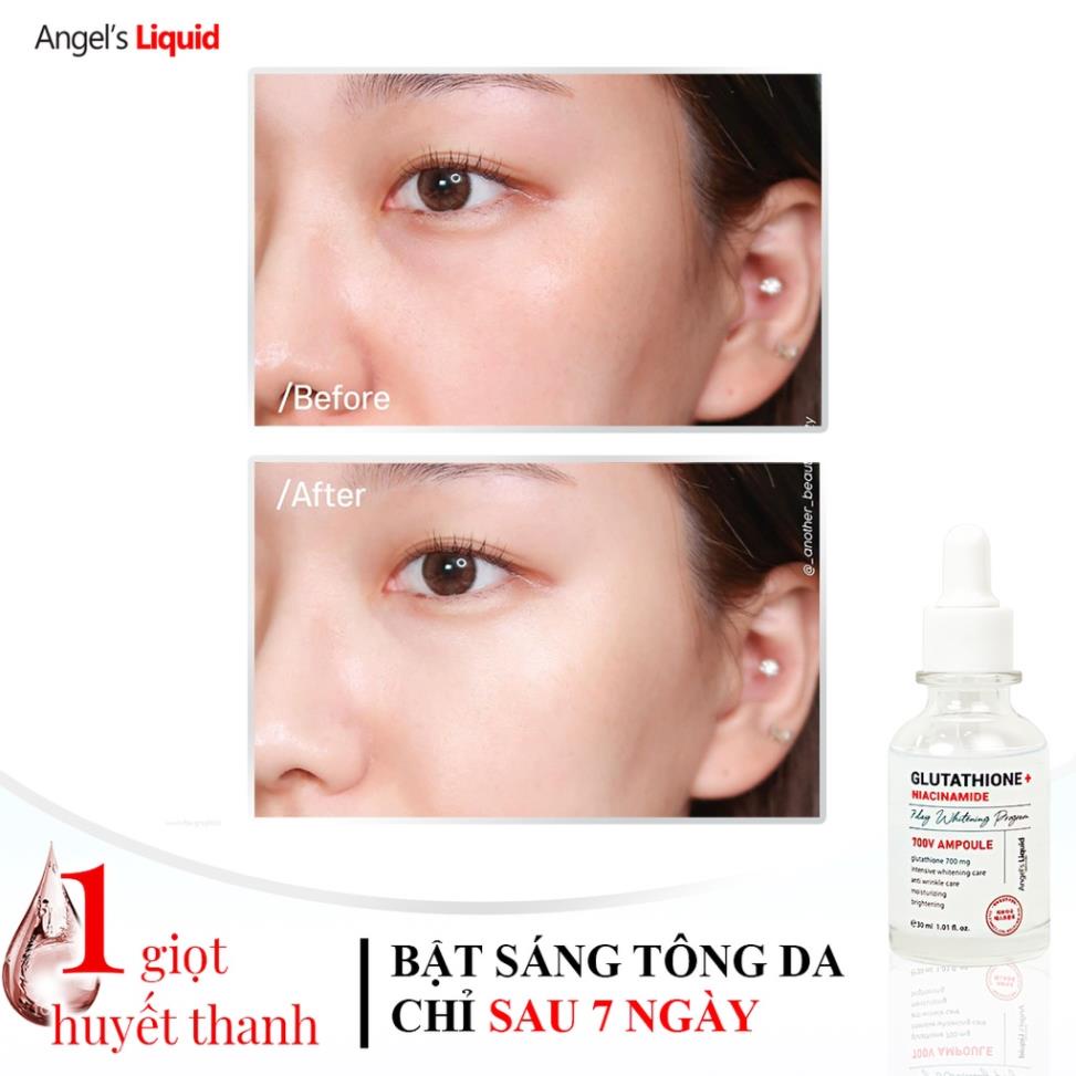 Bộ 3 sản phẩm Nước thần, Huyết thanh, Kem dưỡng mờ nám, dưỡng trắng Angel Liquid Glutathione Plus Niacinamide