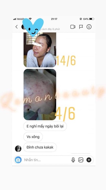 [ MUA 1 MASK TẶNG 1 MASK ] MASK KHỔ QUA RỪNG SALE 84K 🎁 MASK MÔI + CỌ + THÌA PHA | BigBuy360 - bigbuy360.vn