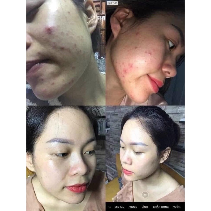 DR MAI NGUYÊN CHẤT 5ML