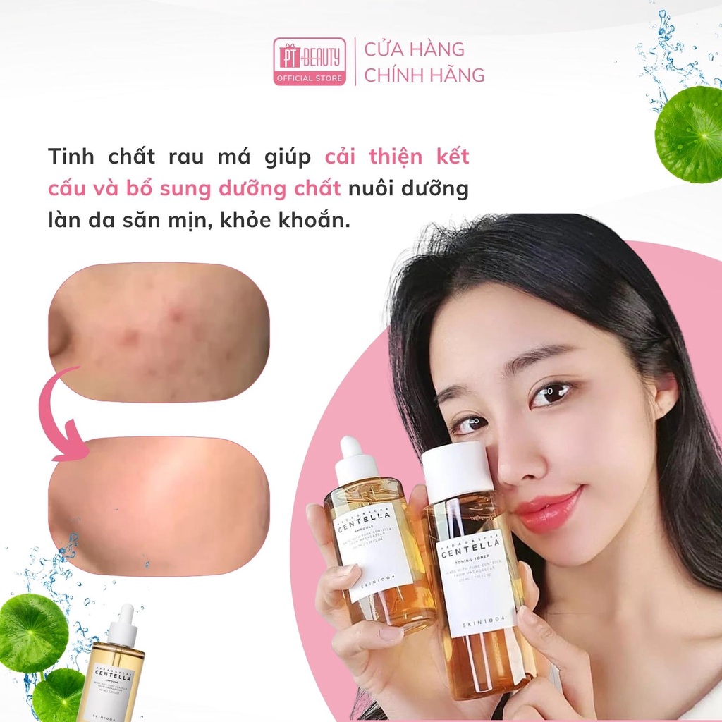 Tinh chất rau má dưỡng da Skin1004 Madagascar Centella Ampoule chai 55ml