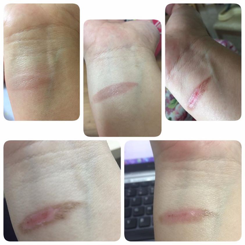 Skinsaver - Kem giải cứu làn da Do Thái  10ml