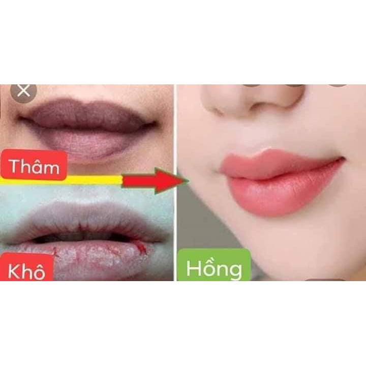 Son sáp dưỡng môi LACO, giúp môi hồng hào, mềm, chống khô môi. | BigBuy360 - bigbuy360.vn