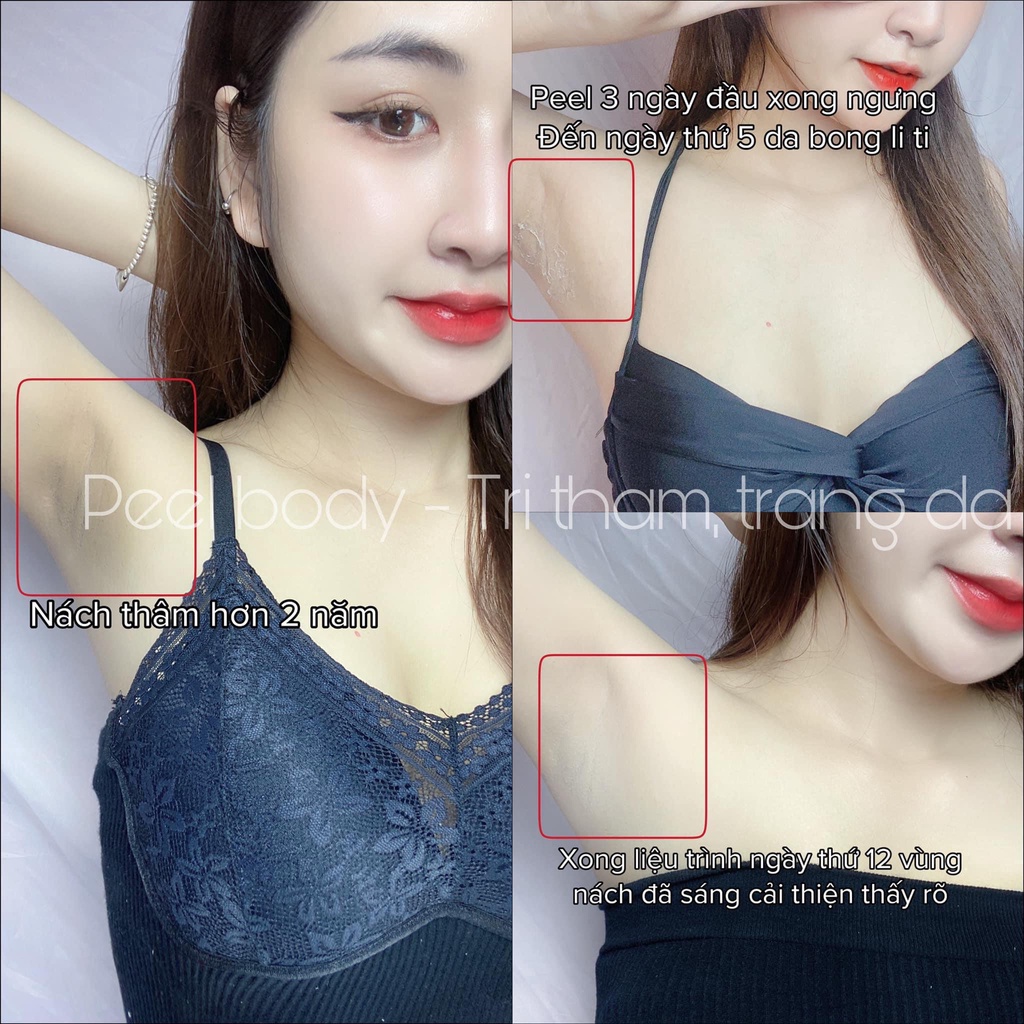 Peel Da Vi Tảo Sinh Học, Peel Nách Body Tái Tạo Da Toàn Thân Thay Da Sinh Học Giúp Dưỡng Ẩm Kích Trắng Mờ Thâm - LE PEAU