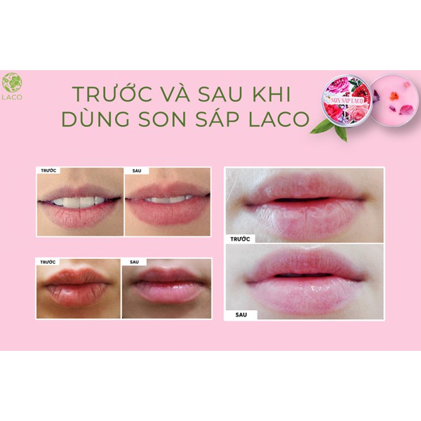 Son Dưỡng Môi Laco 100% Tự Nhiên, Tẩy Da Chết Môi, Làm Hồng Môi, Căng Mọng - LC.SON