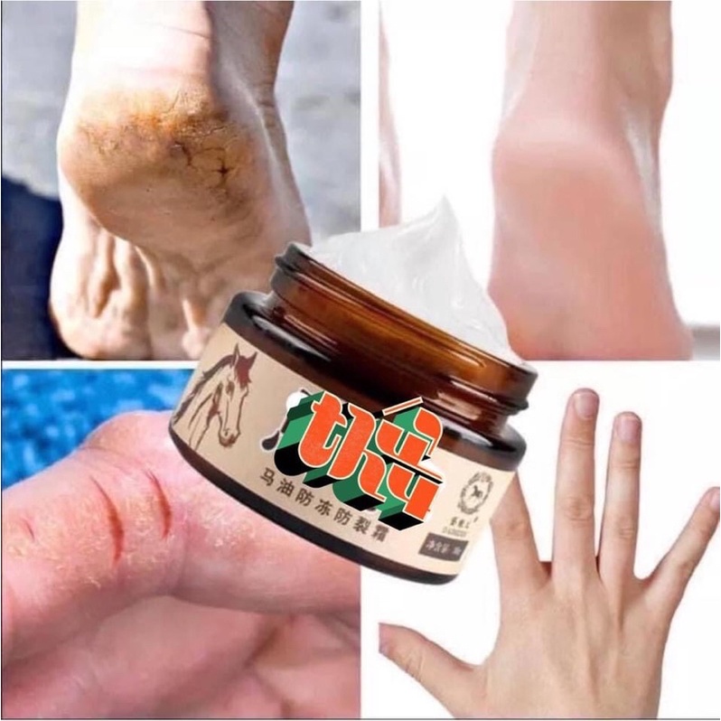 Kem dưỡng gót chân | BigBuy360 - bigbuy360.vn