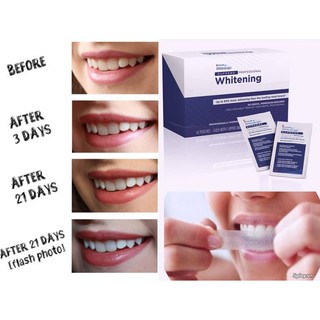 Dán trắng răng Crest 42 miếng