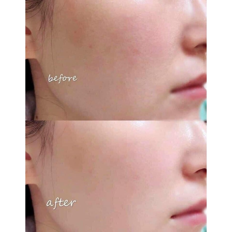 Set Dưỡng Trắng Da Clinique Fresh Pressed 7 Day