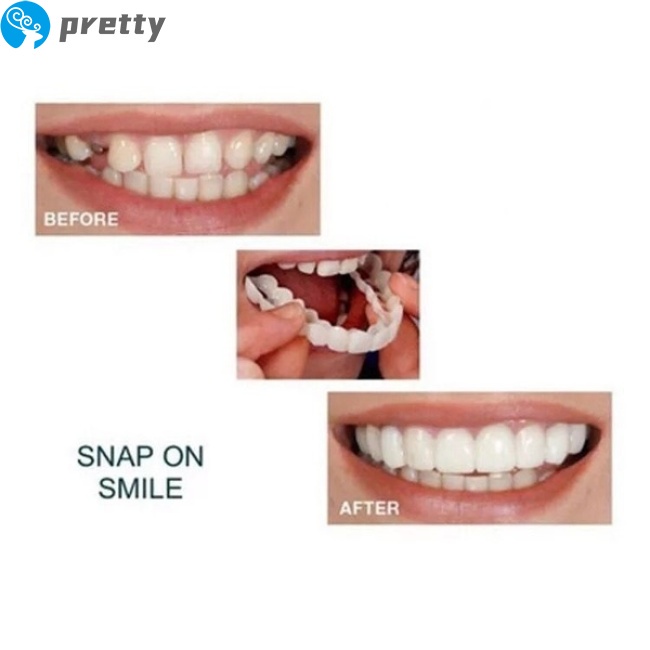 [Hàng mới về] Cặp niềng răng trắng tái sử dụng được tiện lợi