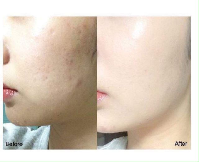 Kem che khuyết điểm The Saem | BigBuy360 - bigbuy360.vn