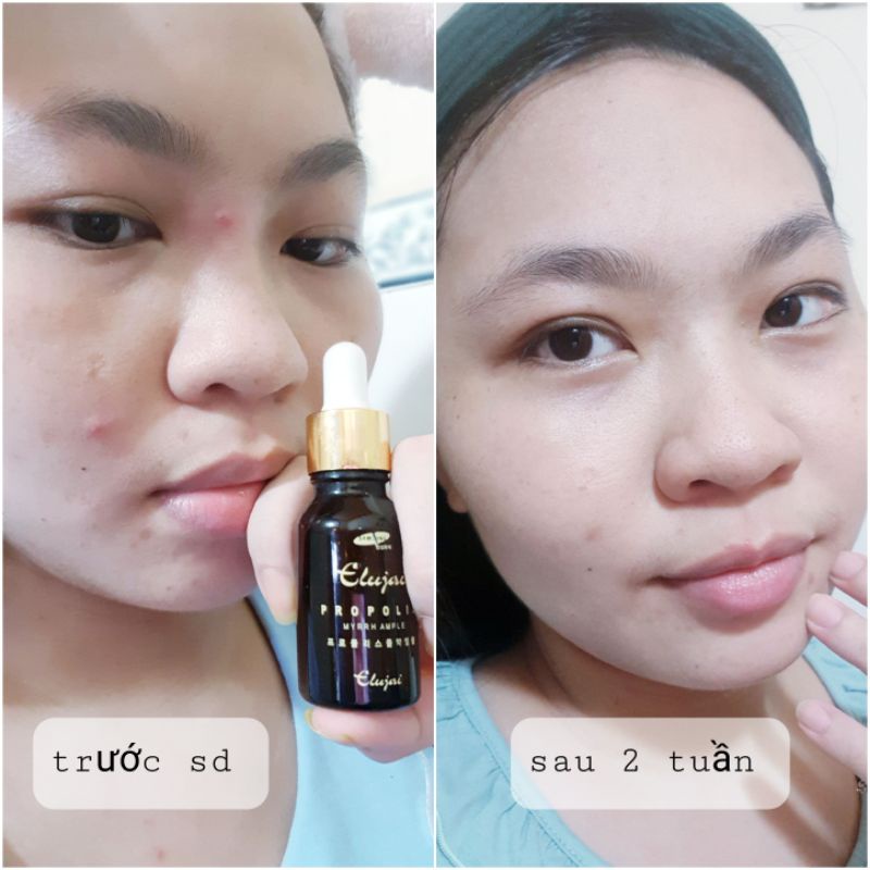 Serum dưỡng trắng hết mụn thâm Elujai Propolis Myrrh Ampoule Light [Chính hãng] nội địa HÀN