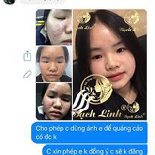 Bạch Linh 02 - Chuyên Mụn