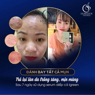 Serum Diếp Cá IGREEN