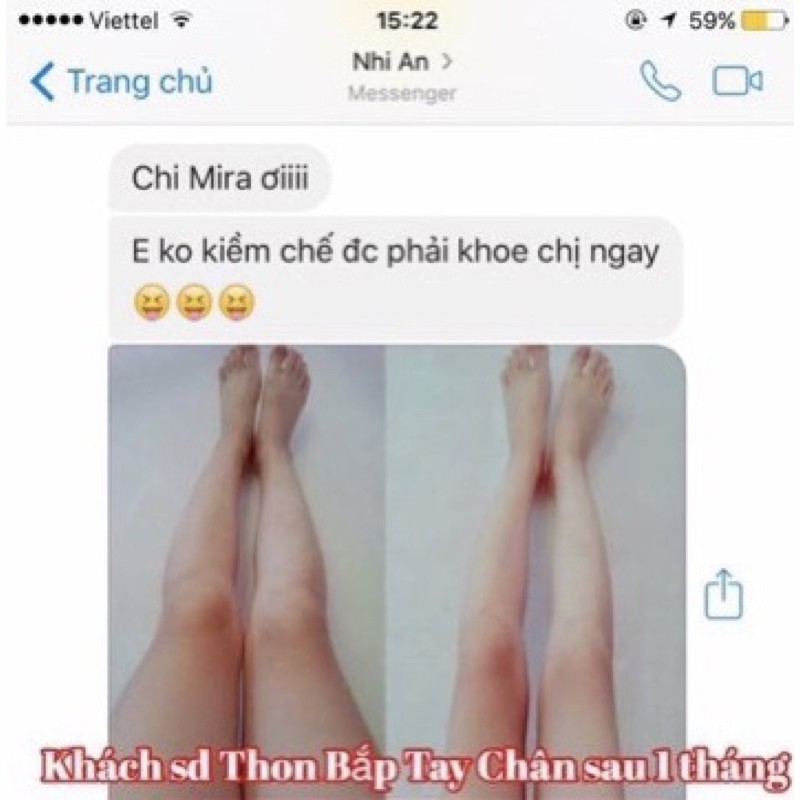 Serum tinh chất thon gọn bắp tay bắp chân - Hàn Quốc (20ml)