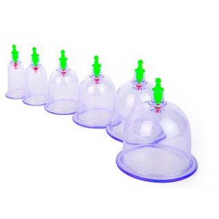 Bộ 12 ly giác hơi không dùng lửa an toàn