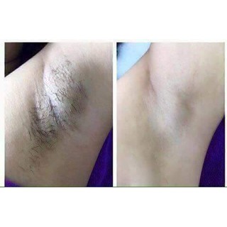 KEM TẨY LÔNG DƯỠNG TRẮNG DA 120 ML