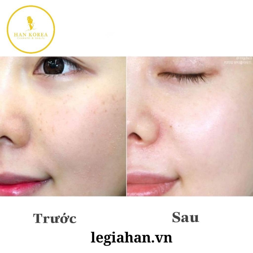Bột uống trắng da GLUTIONC Mẫu mới 1000mg giảm nám, tàn nhang, trắng da 30 gói HÂN KOREA