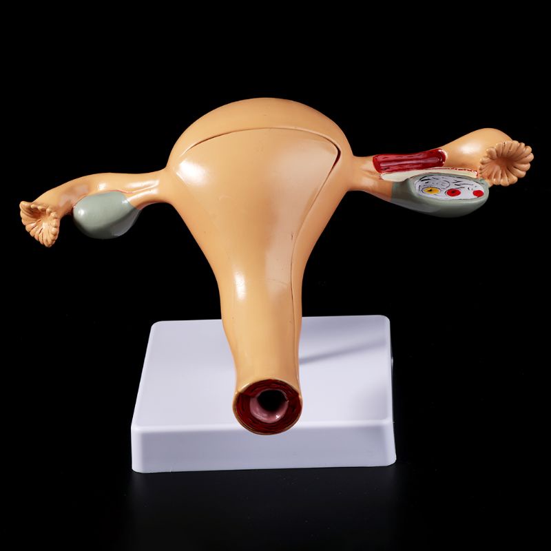 Mô Hình Giải Phẫu Giải Phẫu Lối Đi Con Người Uterus Ovary