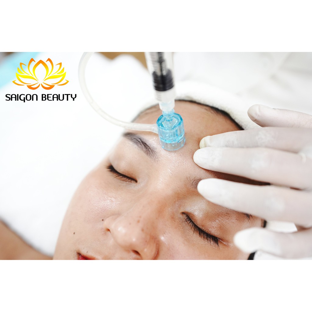 - LIỆU TRÌNH LĂN KIM TRỊ MỤN, TRỊ SẸO RỖ LỖ CHÂN LÔNG TO TẠI TMV SAIGON BEAUTY