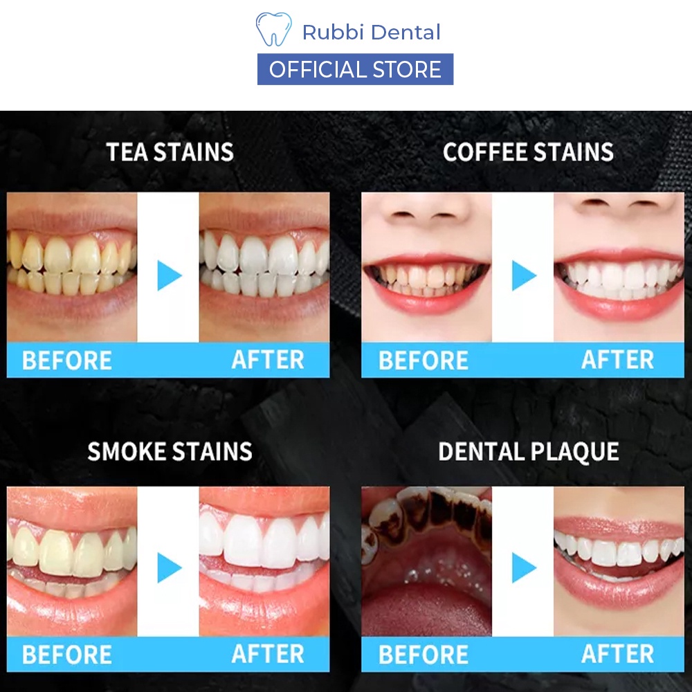 Miếng dán trắng răng SMILEKIT hương bạc hà bật tông cực nhanh