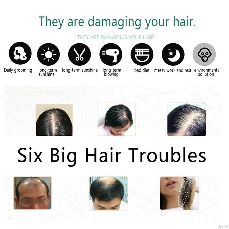 Tinh chất rừng kích thích mọc tóc dày nuôi dưỡng da đầu