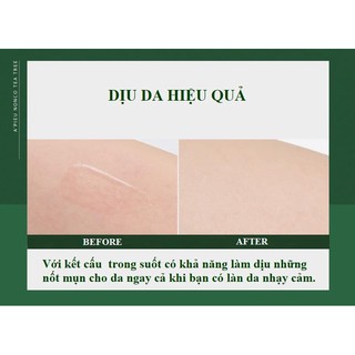 Thanh chấm mụn A’pieu NonCo Tea Tree Stick 8ml
