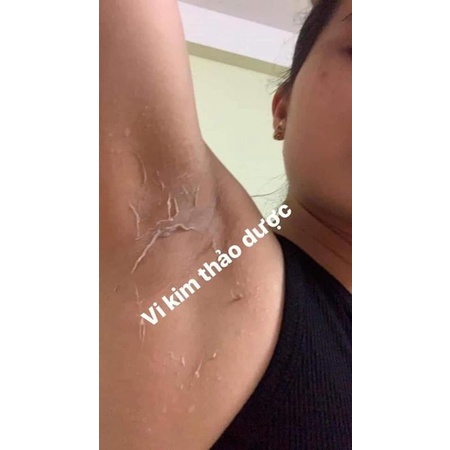 Vi kjm thảo dược hũ lớn 50gr mẫu mới nhất