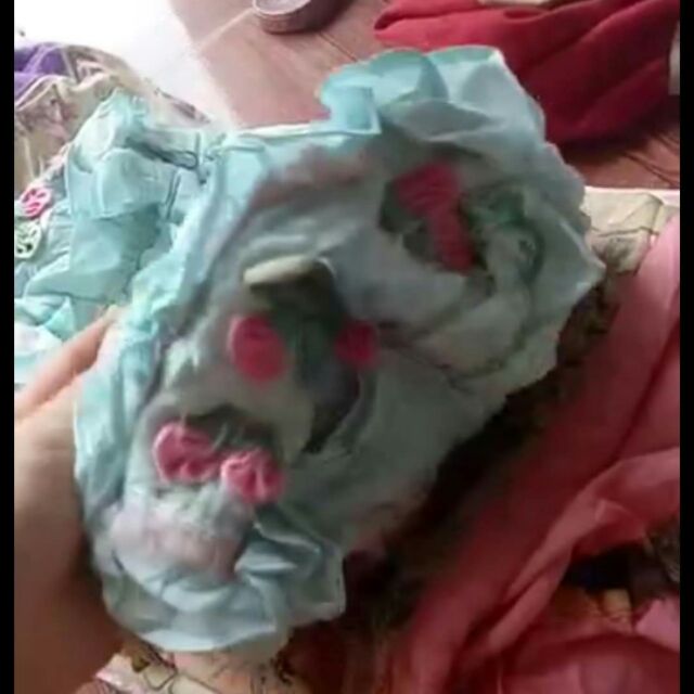 Combo thùy phương