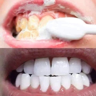 Bột tẩy trắng răng Eucryl