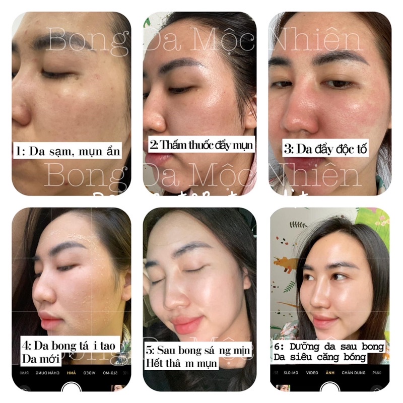 Tái tạo da mộc nhiên đông y (tặng 1 son nhung lì) | BigBuy360 - bigbuy360.vn